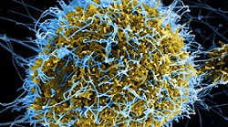 کشف مخفی‌گاه ویروس ابولا در چشم