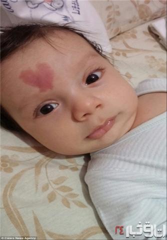 نوزادی با «قلب» روی پیشانی (+ عکس)