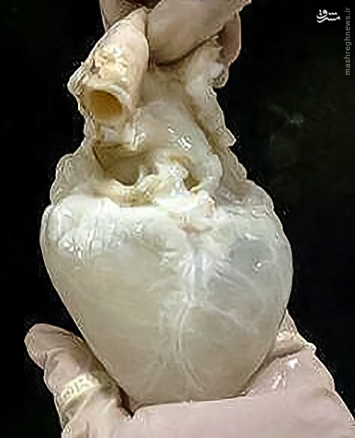 قلب انسان پس از تخلیه خون (عکس)