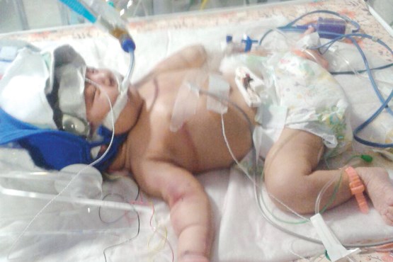 شکایت از پزشک زنان به خاطر مرگ نوزاد 3 روزه