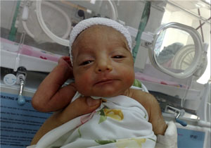 تولد نوزادی با دل و روده بیرون زده (+عکس)