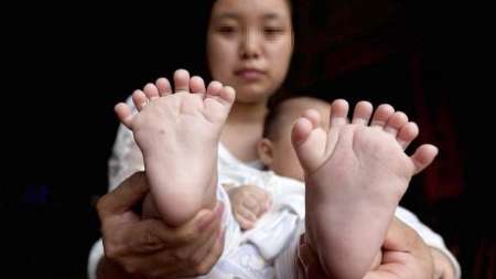 نوزاد 31 انگشتی چینی(+ عکس)