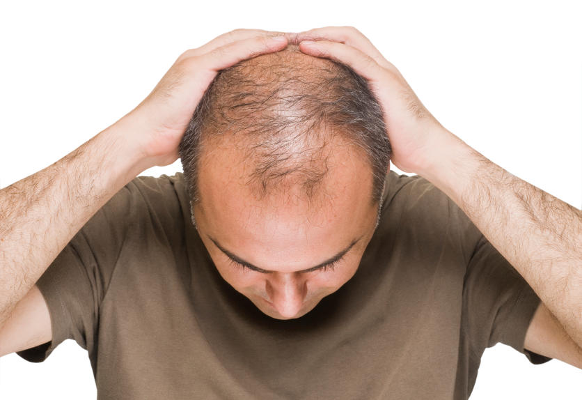 چرا ریزش مو در تابستان بیشتر می شود؟