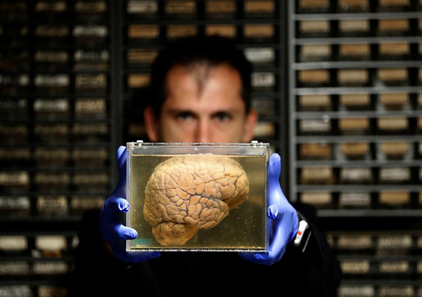 مرکزی که 3 هزار مغز انسان در آن نگهداری می‌شود(+عکس)