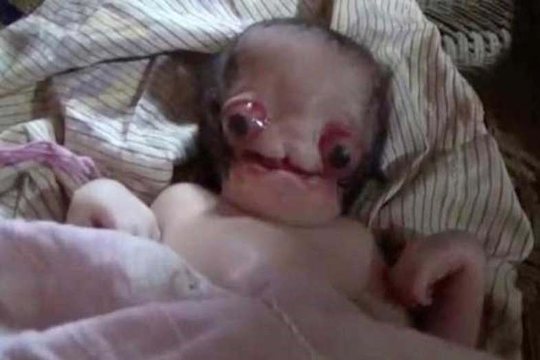 تولد نوزادی شبیه به موجودات فضایی (+عکس)