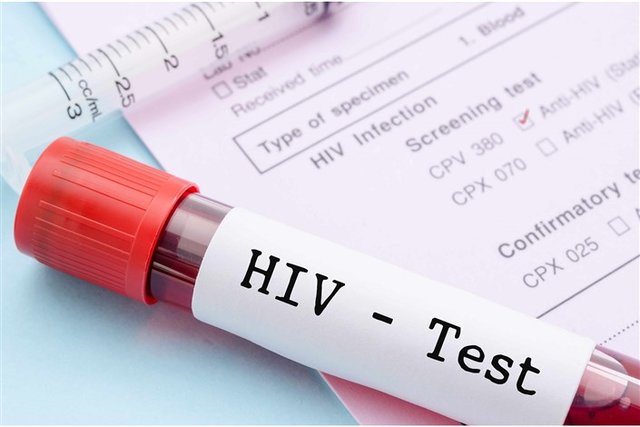 آمارهای رسمی وزارت‌بهداشت از ایدز