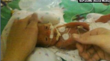 تولد معجزه‌آسای نوزاد 370 گرمی در آمریکا (+عکس)