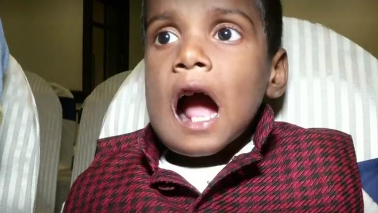 پسر 7 ساله هندی 526 دندان اضافی درآورد (+عکس)