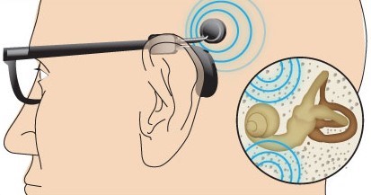 سمعک (hearing aids) چیست؟ راهنمای خرید بهترین سمعک