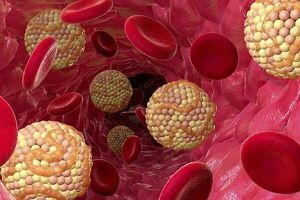 روش‌های درمان خانگی چربی خون بالا