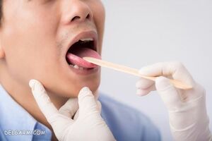 مشکلات دهان و دندان ناشی از دیابت