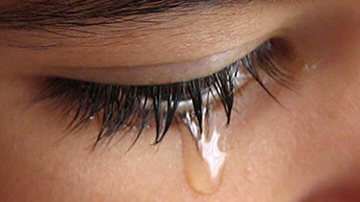 بیماری مرگبار اشک خونین+ جزئیات