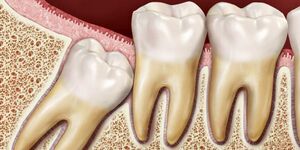 چرا دندان عقل در انسان دیر رشد می‌کند؟