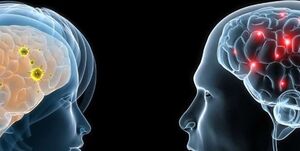 آیا مغز مردان از زنان بزرگتر است؟