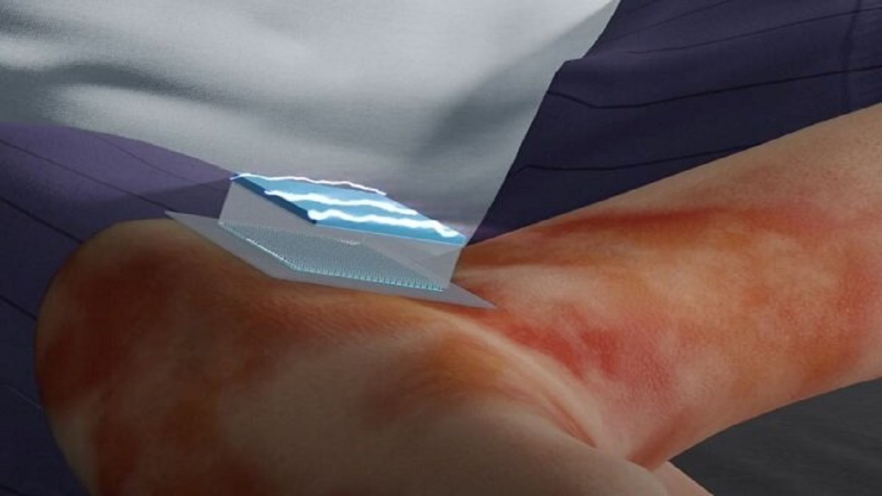 استفاده از نانوتراشه برای تبدیل سلول‌های پوست به رگ‌های خونی