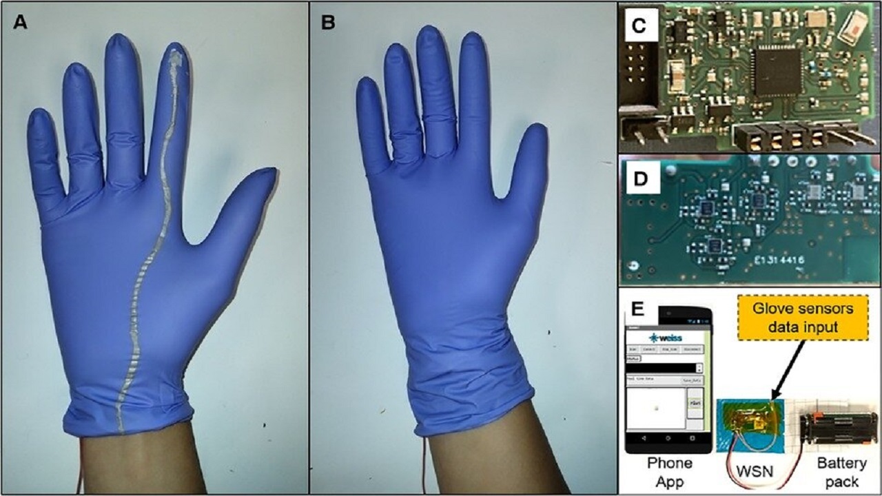 کاهش خطرات زایمان طبیعی با یک دستکش هوشمند