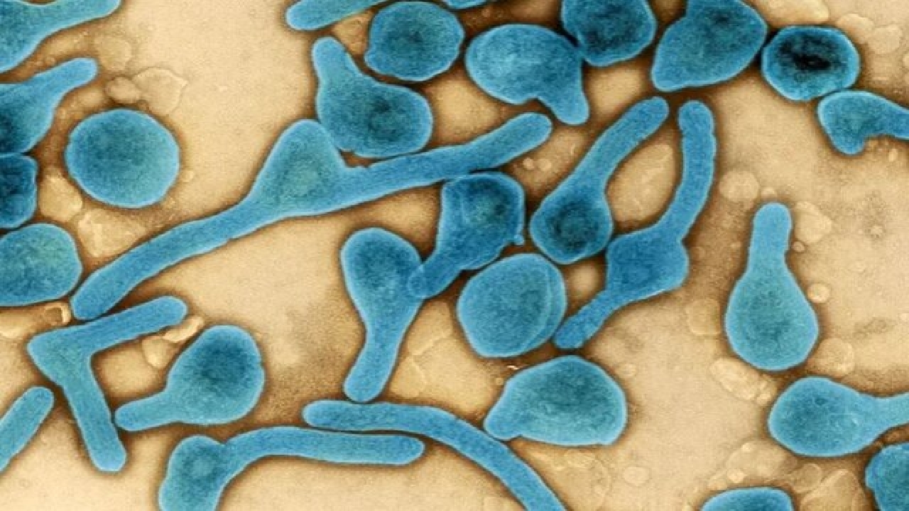 ویروس شایع شده در آفریقا چقدر خطر مرگ دارد؟