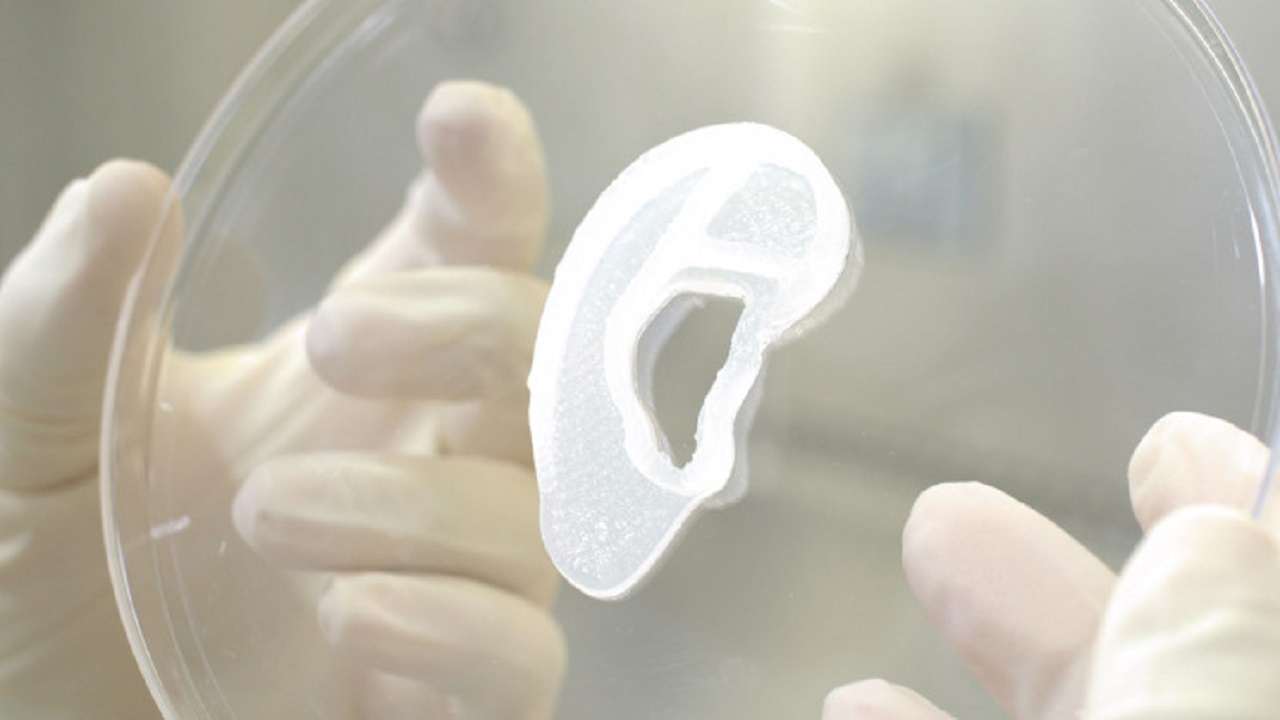 پیوند گوش انسان با چاپ سه بعدی برای اولین بار در جهان
