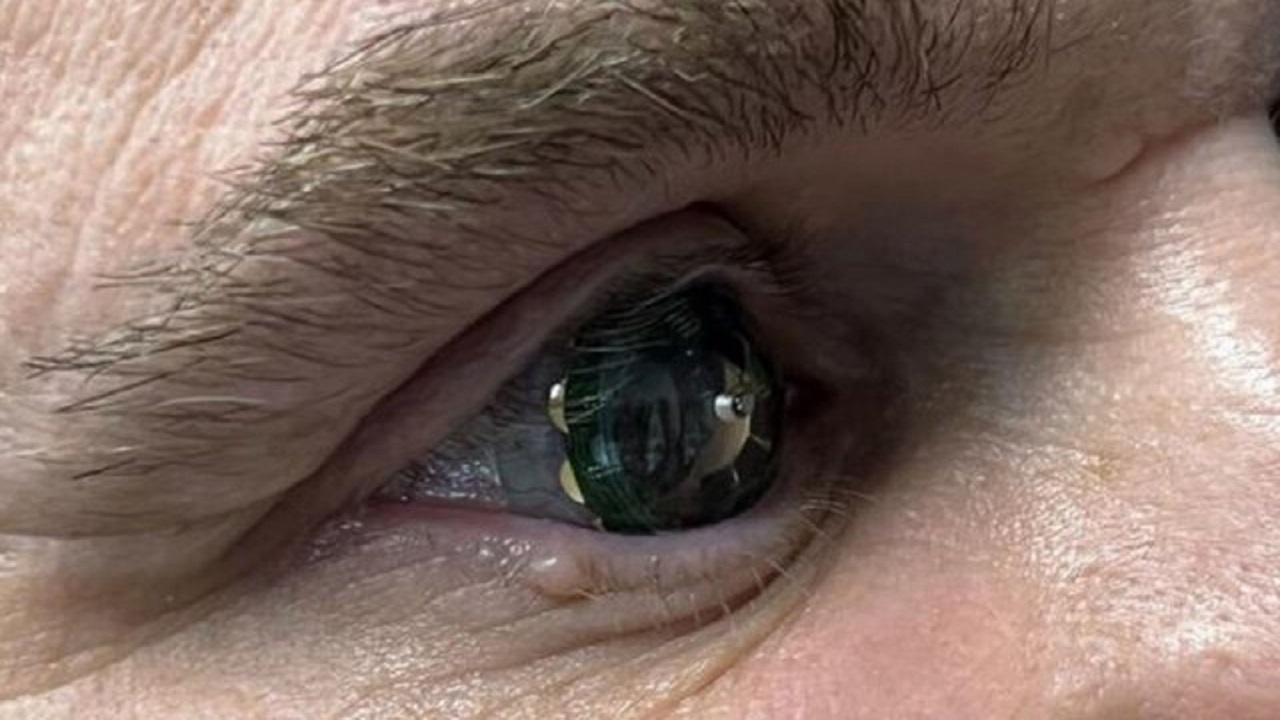 آزمایش لنز‌های هوشمند برای نمایش واقعیت افزوده روی چشم