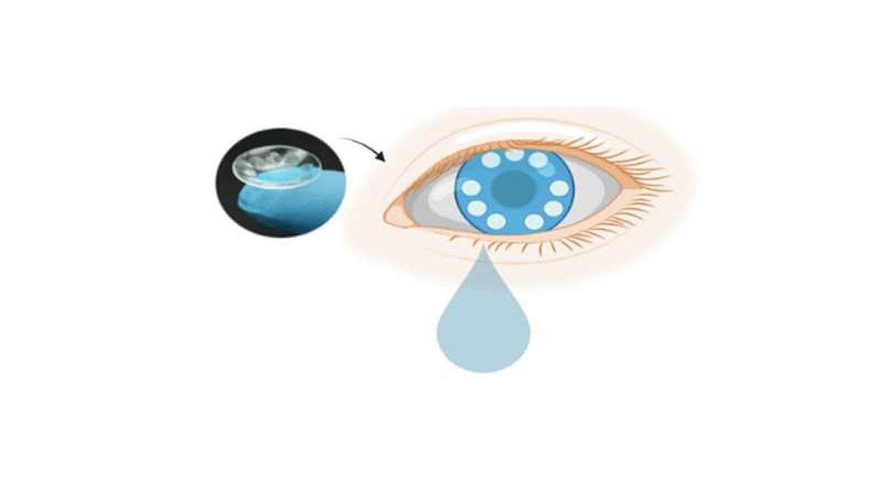 تشخیص سرطان به وسیله لنز هوشمند از روی اشک چشم