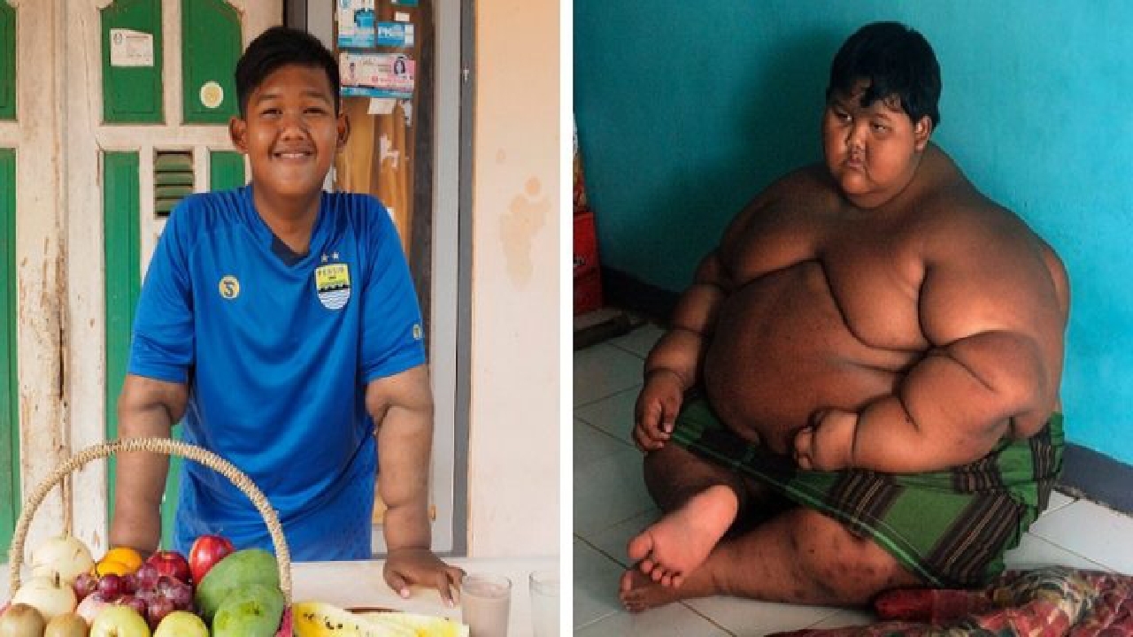 چاق ترین کودک دنیا که با کاهش وزن خود شگفتی ساز شد