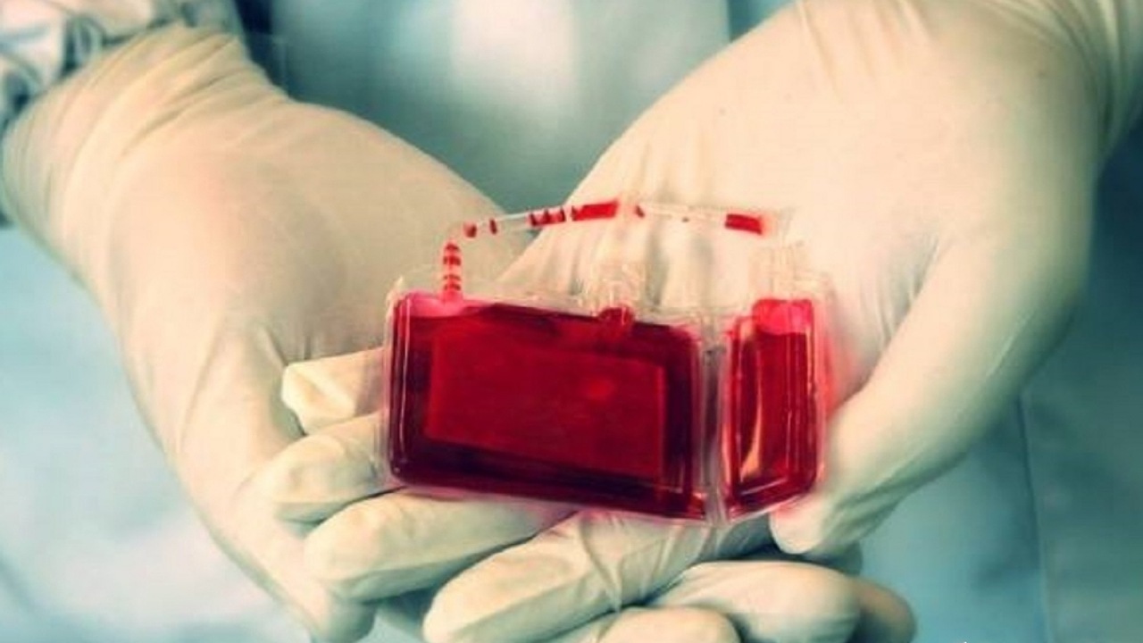 انجام بیش از ۳۰ پیوند سلول‌های بنیادی در زمینه درمان سرطان خون